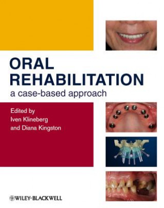 Könyv Oral Rehabilitation - A Case-Based Approach Iven Klineberg