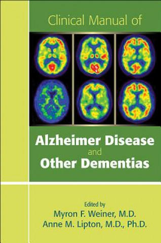 Könyv Clinical Manual of Alzheimer Disease and Other Dementias Myron Weiner