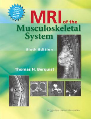 Livre MRI of the Musculoskeletal System Thomas H Berquist