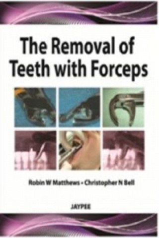 Kniha Removal of Teeth with Forceps Robin W Mathews