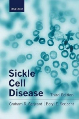 Carte Sickle Cell Disease Serjeant