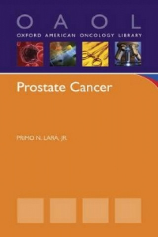 Könyv Prostate Cancer Lara