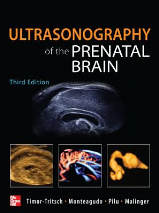 Könyv Ultrasonography of the Prenatal Brain, Third Edition Ilan Timor-Tritsch