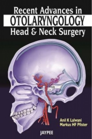 Carte Recent Advances in Otolaryngology - Head and Neck Surgery Anil K Lalwani