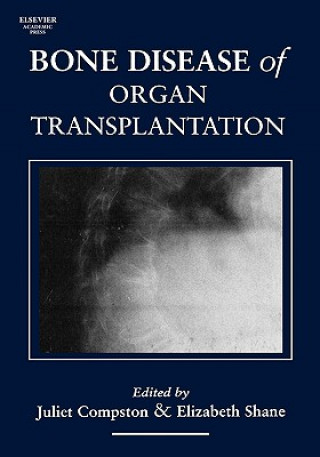 Książka Bone Disease of Organ Transplantation Elizabeth Dr Shane