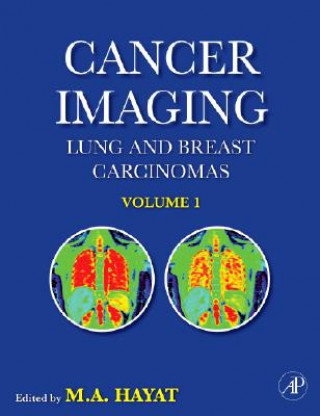 Kniha Cancer Imaging M. A. Hayat