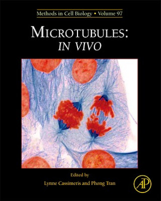 Carte Microtubules: in vivo Lynne Cassimeris