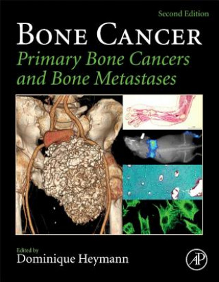 Kniha Bone Cancer Dominique Heymann