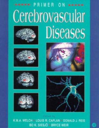 Kniha Primer on Cerebrovascular Diseases Caplan
