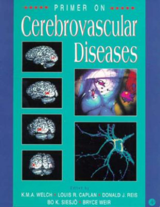 Livre Primer on Cerebrovascular Diseases Caplan