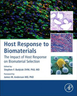 Carte Host Response to Biomaterials Stephen Badylak