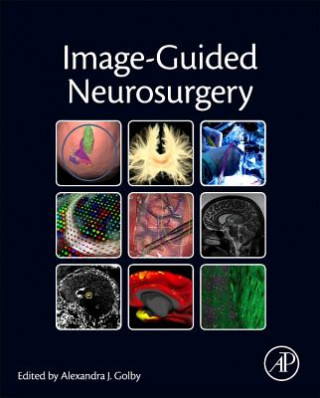 Книга Image-Guided Neurosurgery Alexandra Golby