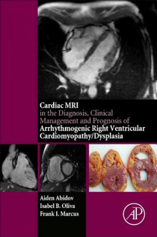 Książka Cardiac MRI in Diagnosis, Clinical Management, and Prognosis of Arrhythmogenic Right Ventricular Cardiomyopathy/Dysplasia Aiden Abidov