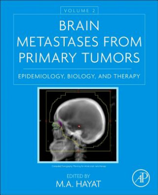 Carte Brain Metastases from Primary Tumors, Volume 2 M. Hayat