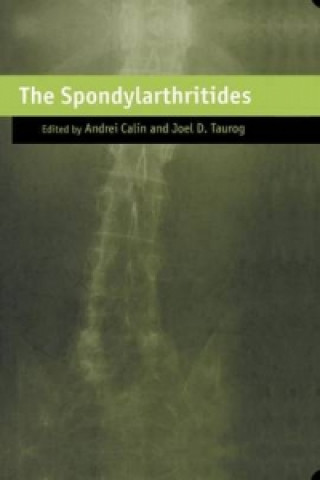 Buch Spondylarthritides Andrei Calin