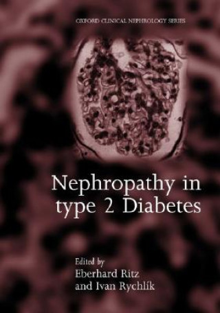 Carte Nephropathy in Type 2 Diabetes Ritz