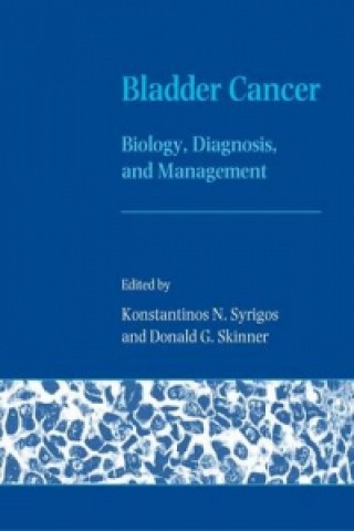 Knjiga Bladder Cancer 