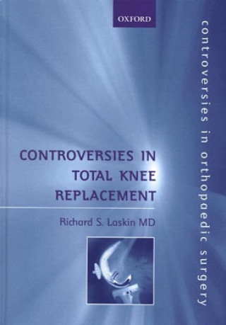 Buch Controversies in Total Knee Replacement Richard S. Laskin