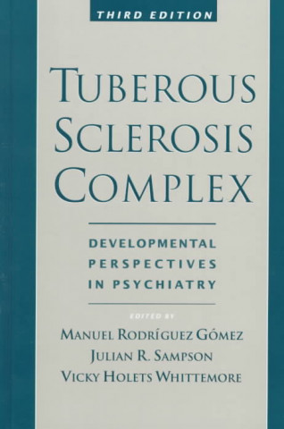 Knjiga Tuberous Sclerosis Complex Manuel Rodriguez Gomez