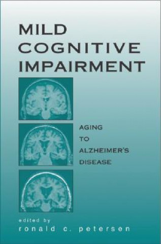 Carte Mild Cognitive Impairment Mayo Clinic
