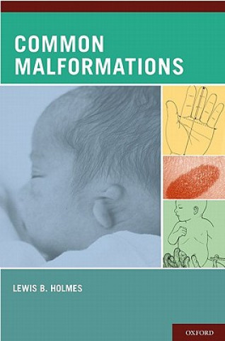 Kniha Common Malformations Lewis B. Holmes