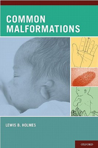 Książka Common Malformations Lewis B. Holmes