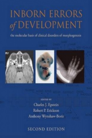 Knjiga Inborn Errors of Development Charles J. Epstein