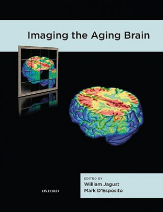 Kniha Imaging the Aging Brain William Jagust