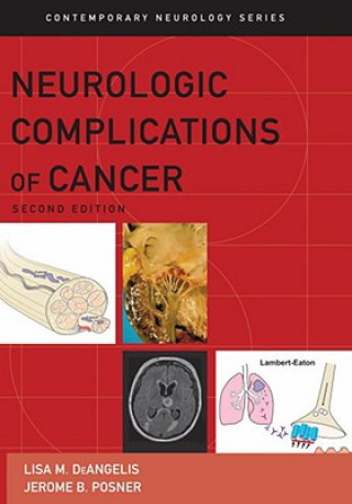 Carte Neurologic Complications of Cancer Lisa M. Deangelis