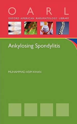Carte Ankylosing Spondylitis Muhammad Asim Khan