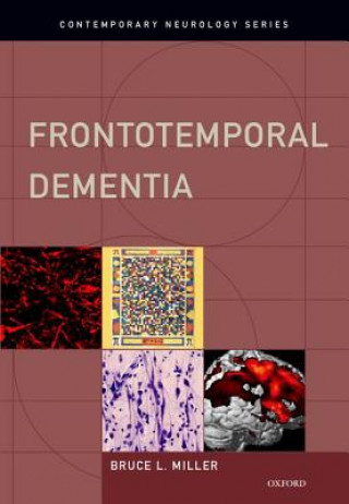 Buch Frontotemporal Dementia Bruce L. Miller