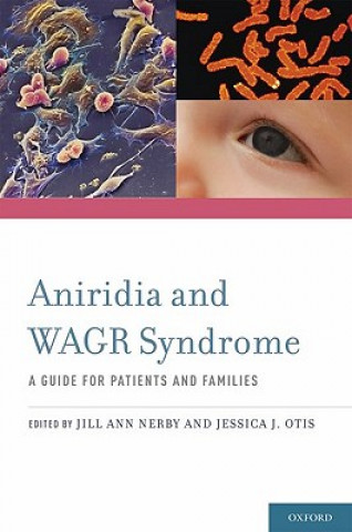 Książka Aniridia and WAGR Syndrome Jill Ann Nerby