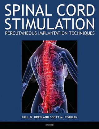 Carte Spinal Cord Stimulation Paul Kreis