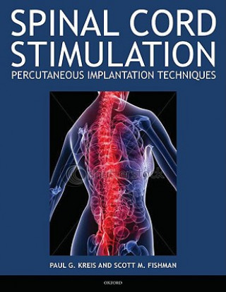 Book Spinal Cord Stimulation Paul Kreis