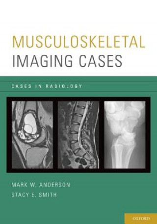 Carte Musculoskeletal Imaging Cases Mark W. Anderson
