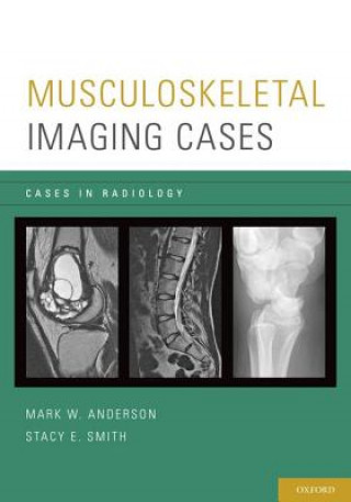 Książka Musculoskeletal Imaging Cases Mark W. Anderson