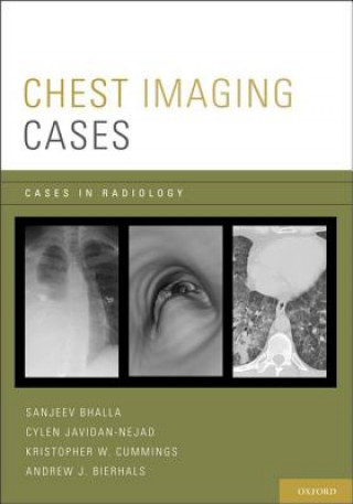 Knjiga Chest Imaging Cases Andrew J. Bierhals