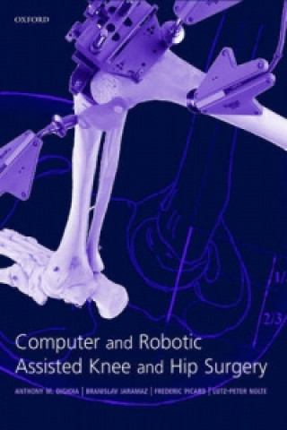 Kniha Computer and Robotic Assisted Hip and Knee Surgery 