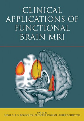 Kniha Clinical Applications of Functional Brain MRI Serge A. Rombouts