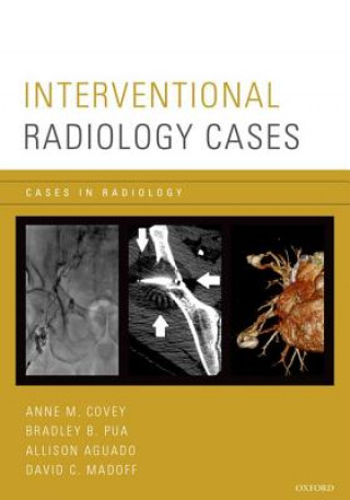 Carte Interventional Radiology Cases Covey