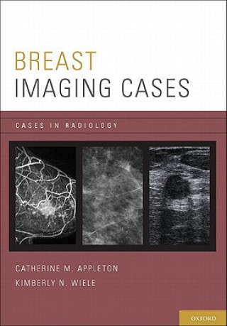 Carte Breast Imaging Cases Catherine M. Appleton