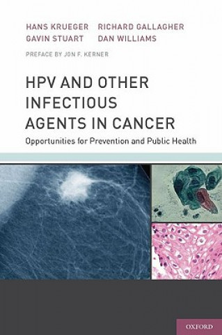 Könyv HPV and Other Infectious Agents in Cancer Hans Krueger
