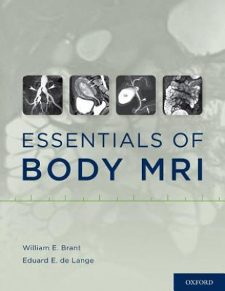 Kniha Essentials of Body MRI William E. Brant