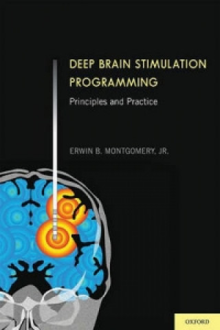 Knjiga Deep Brain Stimulation Programming Erwin B. Montgomery