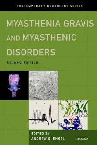 Kniha Myasthenia Gravis and Myasthenic Disorders Andrew G. Engel