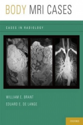 Könyv Body MRI Cases Eduard E. de Lange