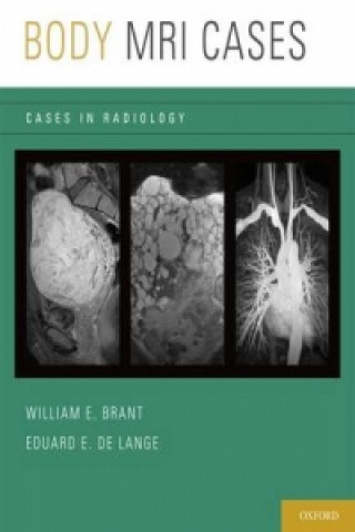 Libro Body MRI Cases Eduard E. de Lange