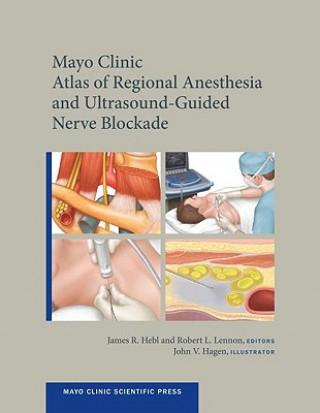 Könyv Mayo Clinic Atlas of Regional Anesthesia and Ultrasound-Guided Nerve Blockade James R. Hebl