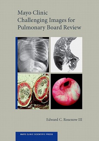 Numérique Mayo Clinic Challenging Images for Pulmonary Board Review Edward C. Rosenow