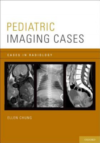 Könyv Pediatric Imaging Cases Ellen Chung